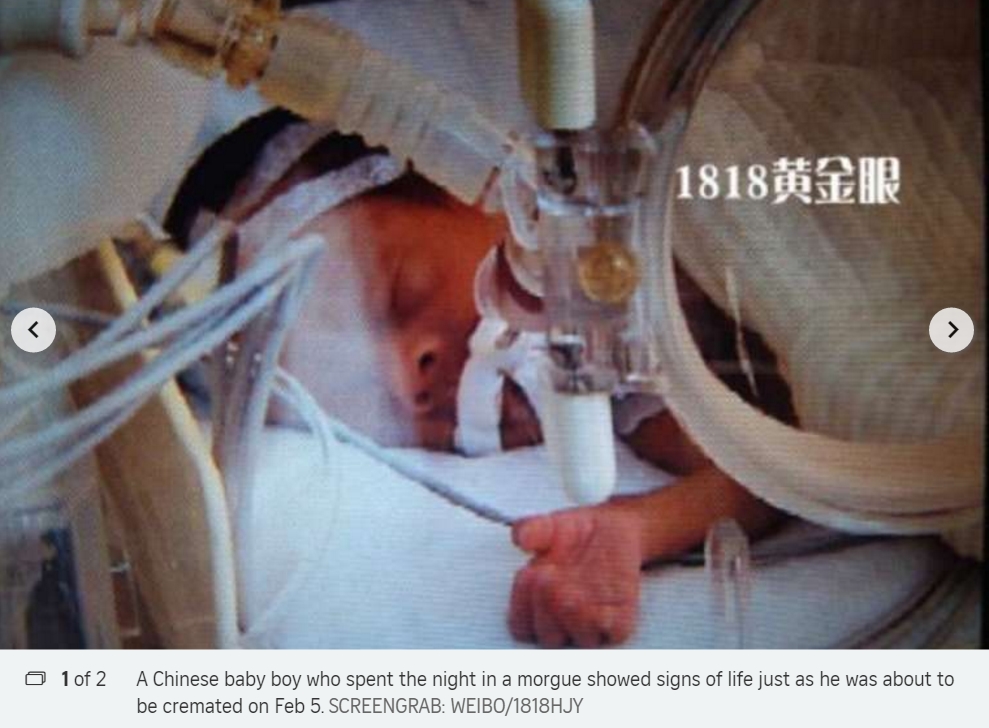 Ce bébé chinois, déclaré mort, a donné signe de vie pendant les préparatifs de son incinération.
